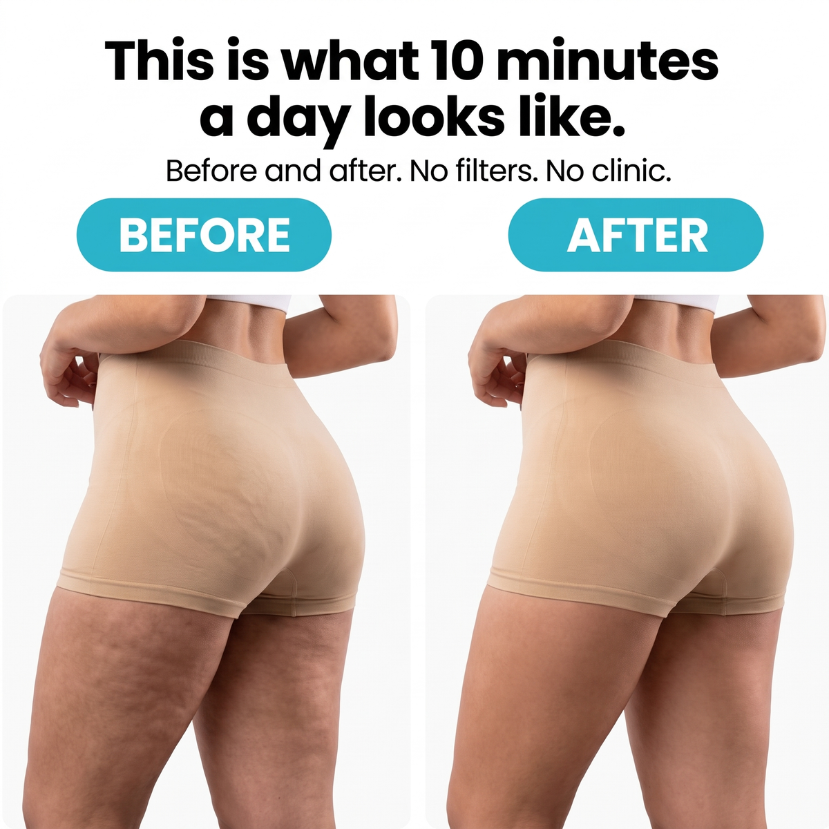 WAPORIA  Cellulite Reliever