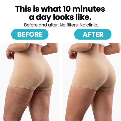 WAPORIA  Cellulite Reliever